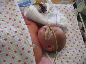 Jelka haar hoofdje weer goed te zien. Ze houdt veel vocht vast, verdwijnt in de komende weken.