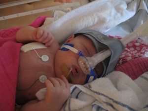 Hee, eindelijk ben ik van het slangetje in mijn neus af! Maar nu heb ik CPAP (soort snorkeltje)