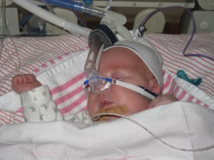 Jelka met 'snorkeltje' = CPAP (druk + zuurstof)